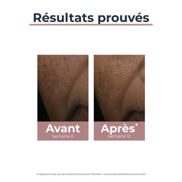 ANTI-PIGMENT - Correcteur de Taches - Visage - Tous Types de Peaux, 5ml