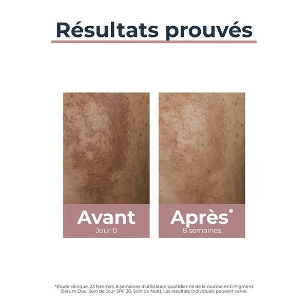 ANTI-PIGMENT - Soin de Jour SPF30 - Visage - Tous Types de Peaux, 50ml