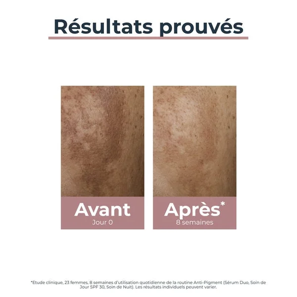 ANTI-PIGMENT - Sérum Duo - Visage - Tous Types de Peaux, 30ml