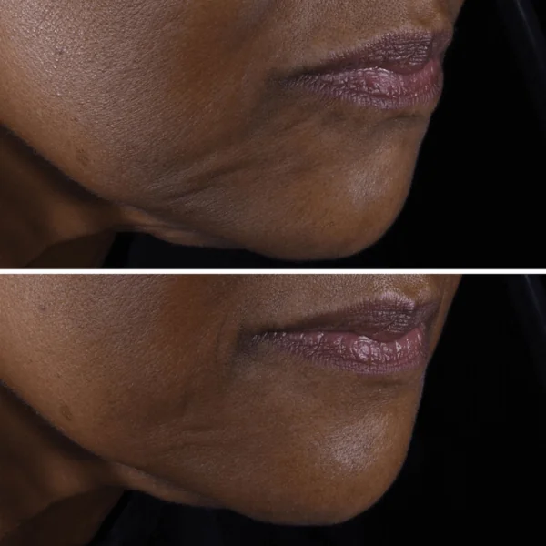 Clinique - Smart Clinical Repair Crème liftante visage et cou