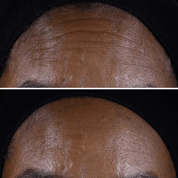 Clinique - Smart Clinical Repair Crème liftante visage et cou