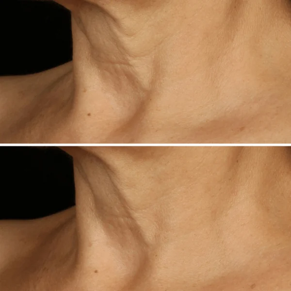 Clinique - Smart Clinical Repair Crème liftante visage et cou