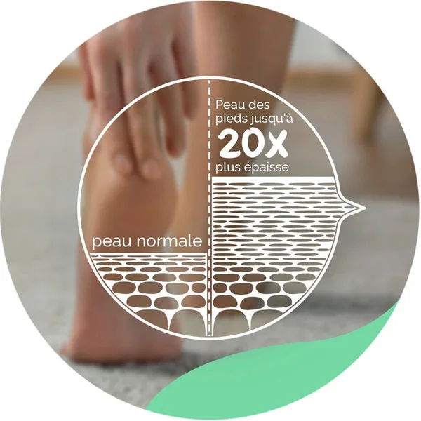 EXPERTCARE - Crème Hydratante Quotidienne - Pieds - Peaux Normales à Sèches, 150ml