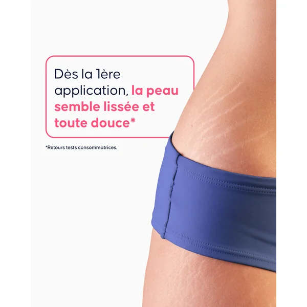 Gommage Vergetures