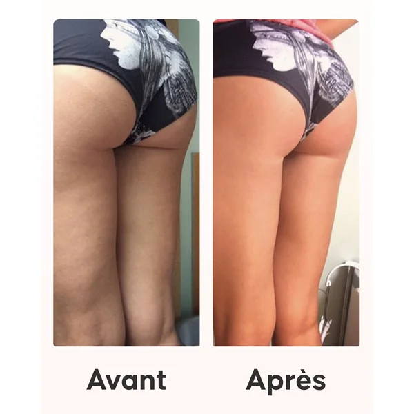Programme Cellulite Douche