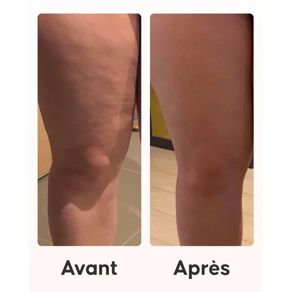 Programme Cellulite Top Chrono