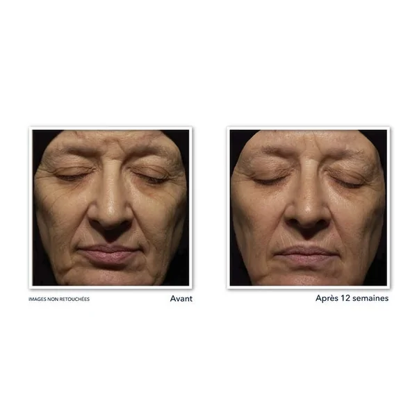 RETINOL CORREXION® - Correction Rides Crème Nuit, 30ml