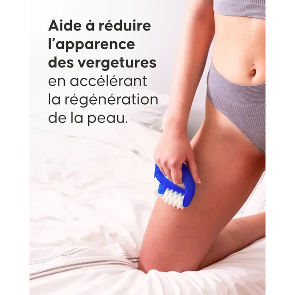 Rouleau Vergetures